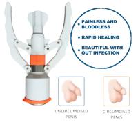 ODM ZSR Disposable Circumcision Stapler for Anorectal Urology Surgery