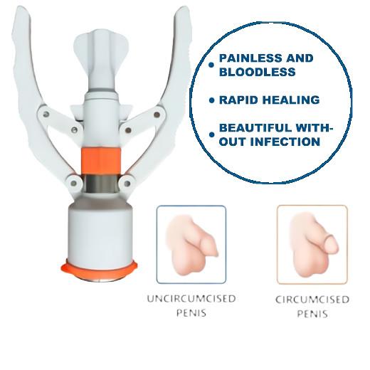 Foreskin Cut Disposable Circumcision Stapler Male ZSR Machine