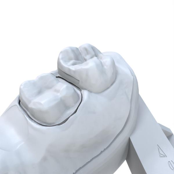 Modelo Dental de Resina de Duração Longo Reparação Modelo Dental de Resina Impressão 3D