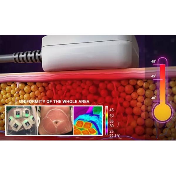 Máquina portátil 10 de la belleza de Trusculpt Rf en 1 rejuvenecimiento de la piel