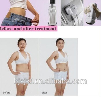 Liposunix Vertical Hifu Body Slimming Machine With 8mm / 13mm Treatment Heads