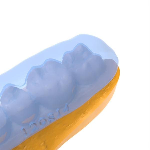 Résine thermotrope pour coussinet de mâchoire transparent