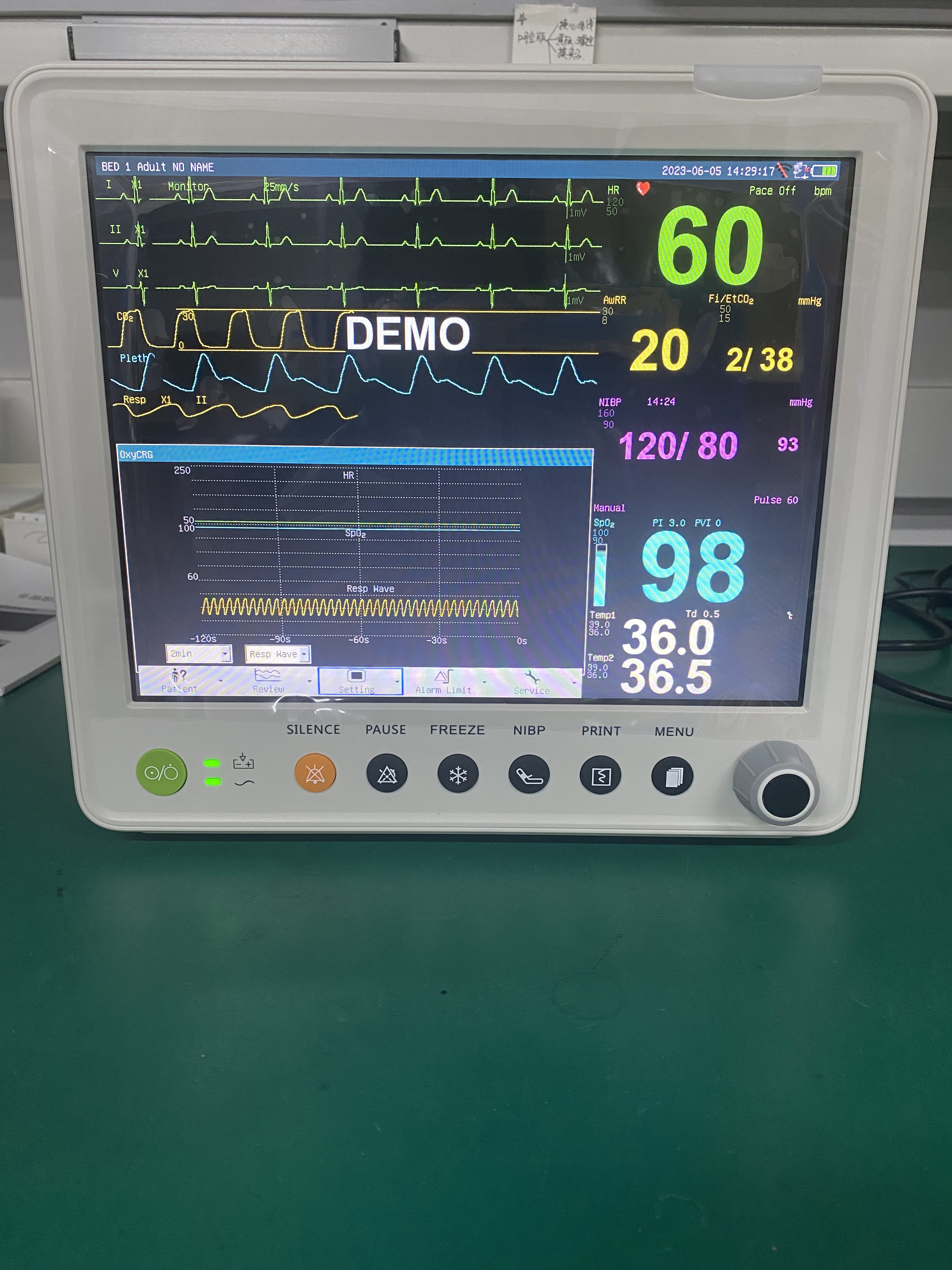 Портативный терпеливый монитор с параметрами PR ETCO2 ECG NIBP SPO2 RESP TEMP