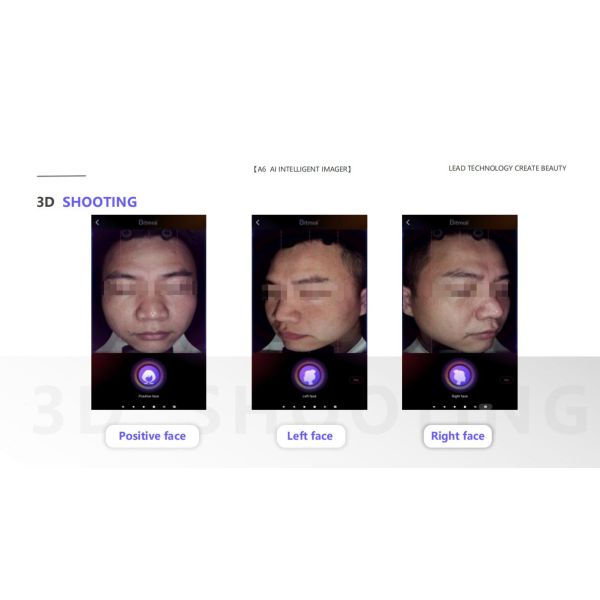 Beauty Spa Skin Care CentersDigital Partner For Skin Analysis With Al Intelligent System Acne Pigment Pores Test and Analysis