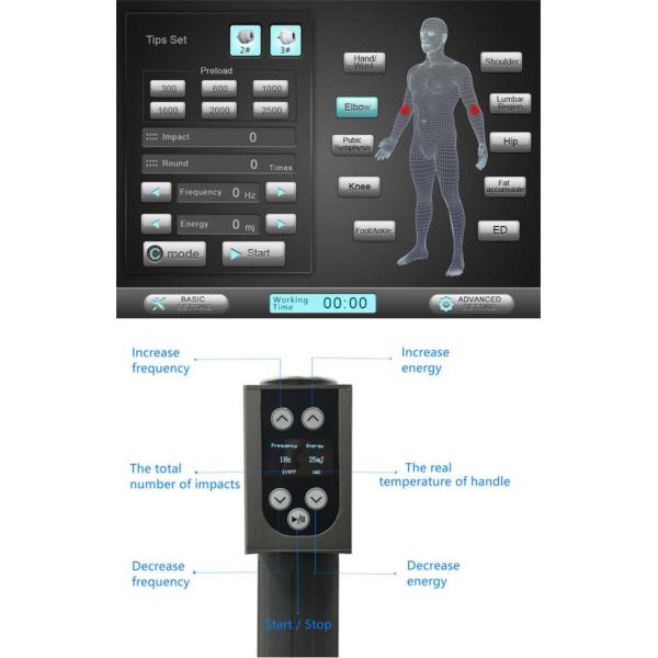 Les blessures et les cellulites de sport de physiothérapie de machine d'onde choc de STATION THERMALE traitent