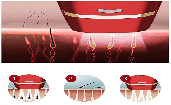 Дома удаление волос лазера Эпилатор мини ИПЛ съемок машины 600000 красоты постоянное