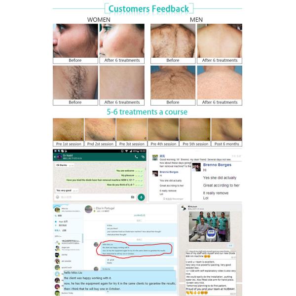 professional 808 diode laser big spot soprano ice permanent laser hair removal machine,optic diode laser