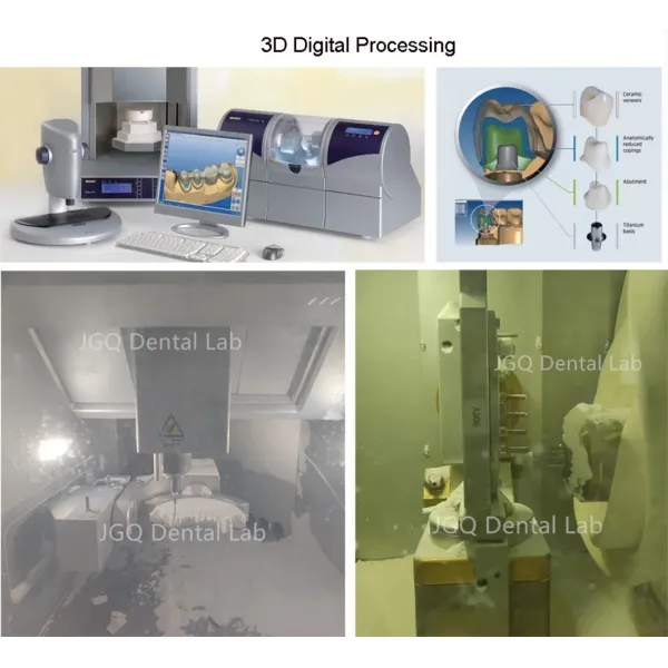 China Dental Lab Digital Full Dentures Using CAD/Cam Technology 3D Printing and Skilled Technicians