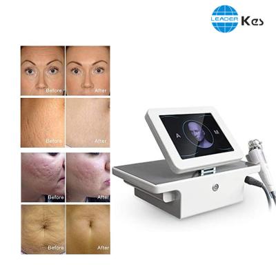 Skin Tightening ISO13485 2MHz - 4MHz Microneedle Rf Machine