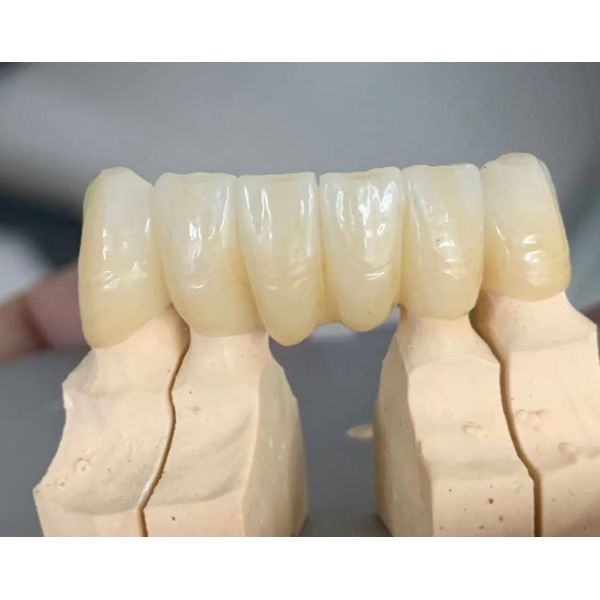98mm 3D Plus Multilayer Dental Zirconia Blocks YUCERA the Best Dental Zirconia Discs Materials for CAD/CAM System Lab