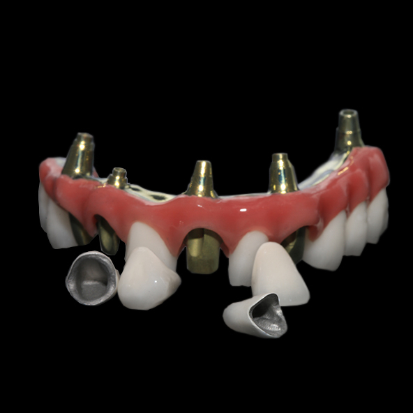 Dental PFM Crown And Bridge Customizable With CoCr Ceramic Materials