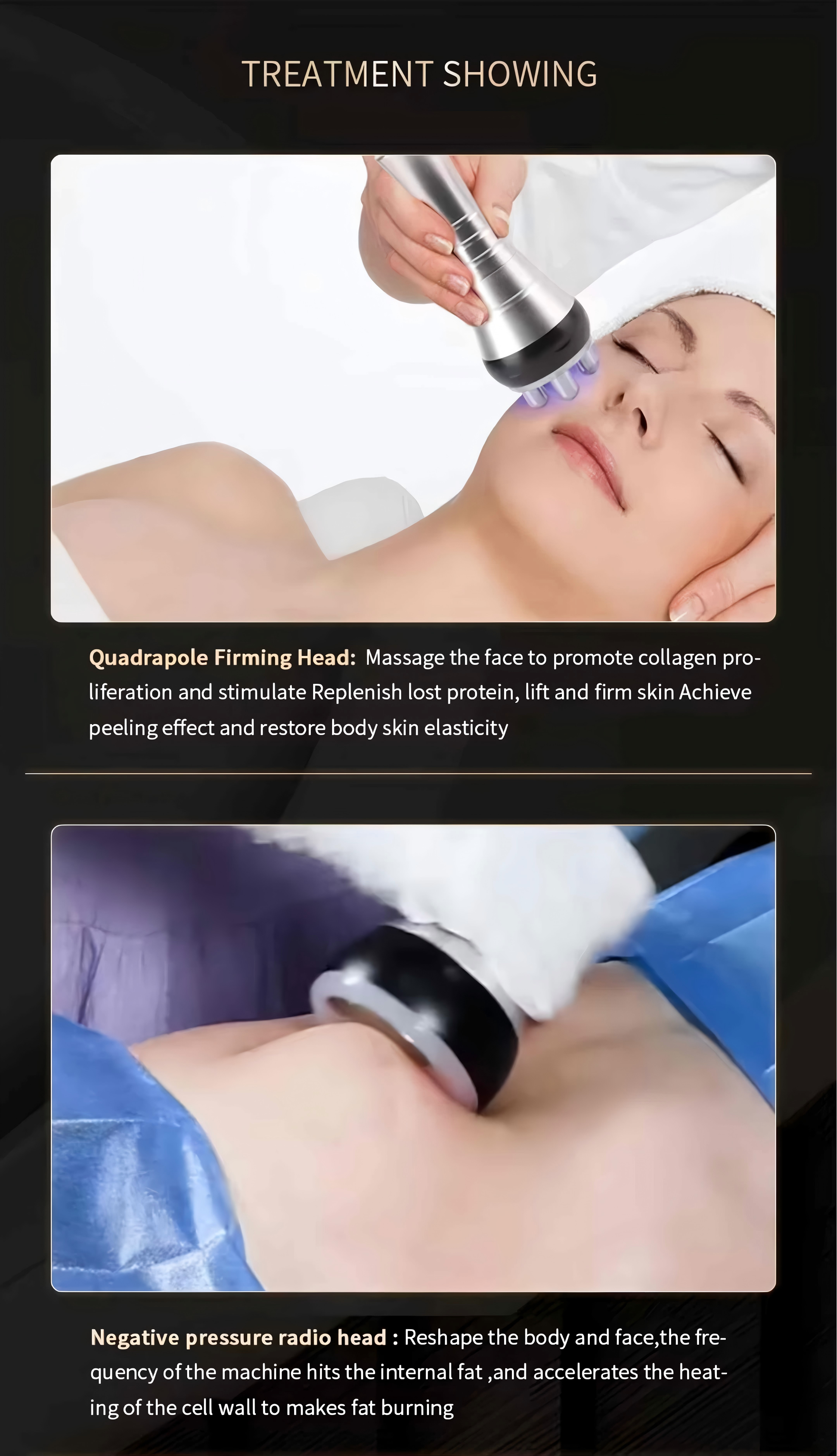 40K Cavitation Slimming Machine , RF Vacuum Lipo Laser Machine For Body Shaping