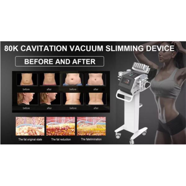 80k Rf Cavitation Vacuum Device Ultrasonic Skin Lifting Fat Removal Lipo Laser Pads Beauty