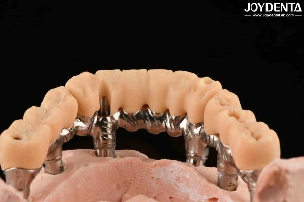 Yellow Resin Temporary Teeth Smooth Surface Treatment Precise And Stable