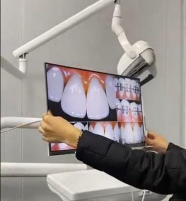 O monitor dental 21,5 do computador de secretária da montagem da parede avança a câmera oral intra do monitor branco da visualização ótica do diodo emissor de luz do LCD