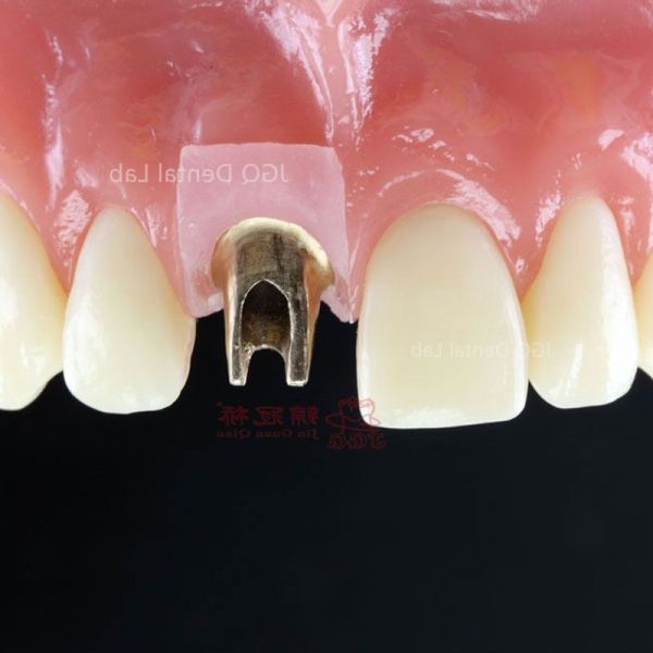 Titanium Zirconia Custom Dental Abutments for Dental Restoration