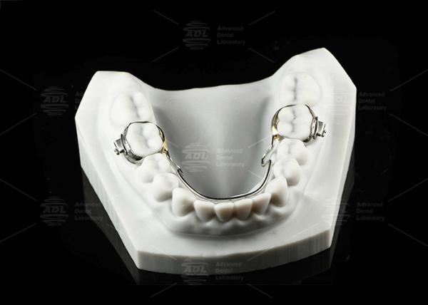 Lingual Arch Biliteral Space Maintainer Stainless Steel Teeth Space Maintainers