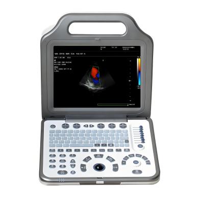 12.1 LED Home Medical Device Portable Color Doppler Ultrasound System OEM