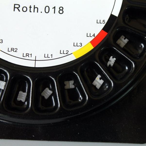 Mbt 022 Ceramic Dental Bracest Lower Friction Force For Orthodontic Treatment