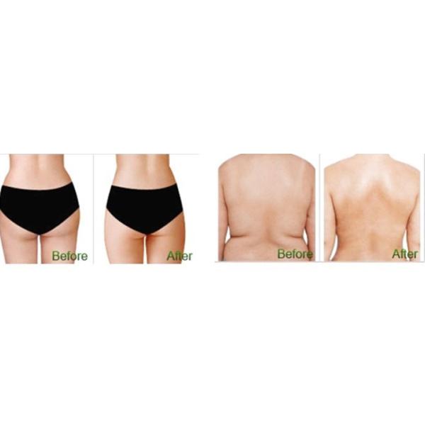 Liposonix Body Shaping HIFU Beauty Machine 600 Shots Cartridge Shots Effective