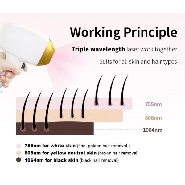 3 In 1 Soprano Sapphire 808 Diode Laser Hair Removal Device Ipl Laser Hair Removal