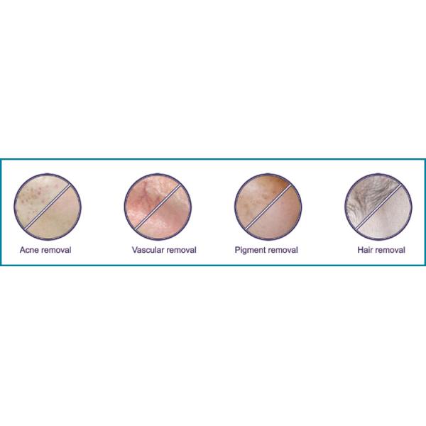 3 Handpieces IPL Skin Rejuvenation Machine Super Hair Removal Flexible Screen