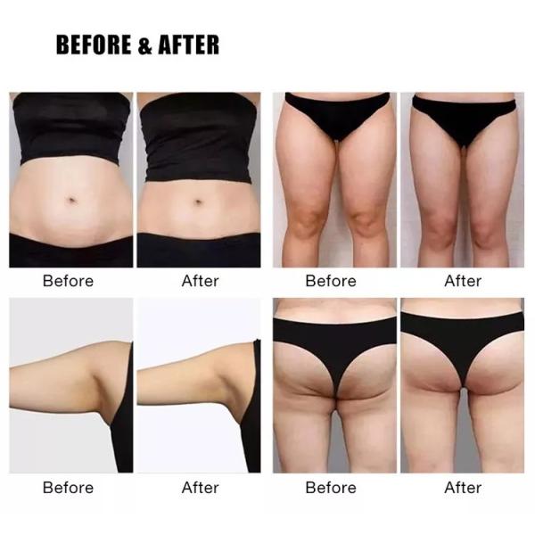 Neo Emt Rf Technology Ems Body Sculpting Machine Touch Screen