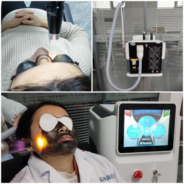 Non Invasive Picosecond Pigmentation Depilation Pigment Tattoo Removal Diode Laser Fractional Q-Switched Nd Yag Beauty