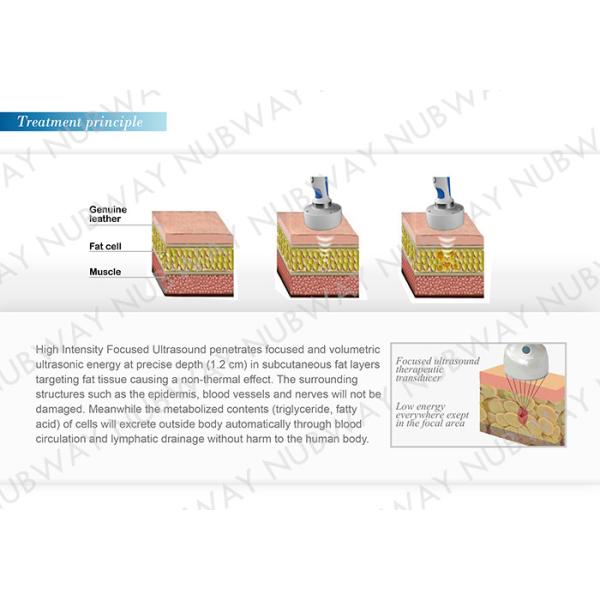 Nubway Beauty Equipment HIFUSHAPE HIFU Ultrasound Weight Loss Machine
