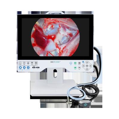 15.6 pouces rigide tout en un système de caméra endoscopique de qualité médicale 1080P avec fonction de lecture locale