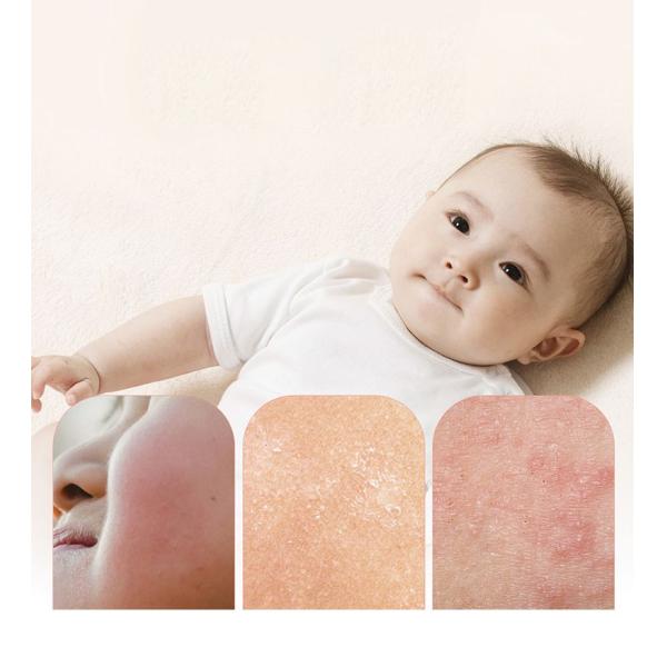 Ceramide Jojoba Seed Oil Bath 400ml For Sensitive Skin Soothing Itch Relieving