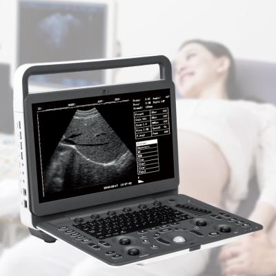 Sonoscape E2 Ecografo Cardiac Vascular Diagnosis B/ 2B/ 4B/ M/ Color Doppler Ultrasound Machine Requipo De Ultrasonido