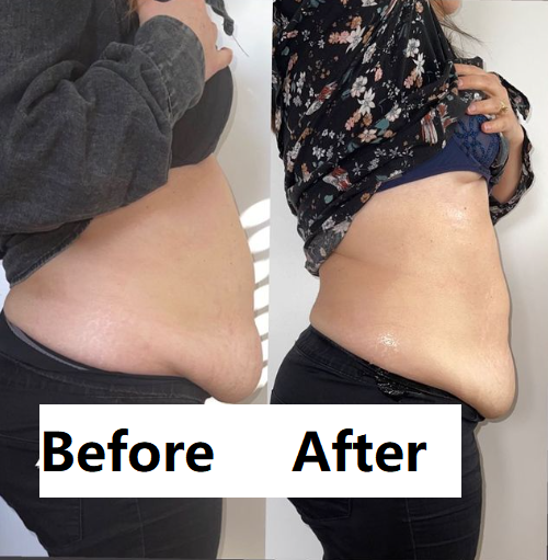 2023 6 en 1 Máquina de belleza de salón de belleza de pérdida de grasa del vientre