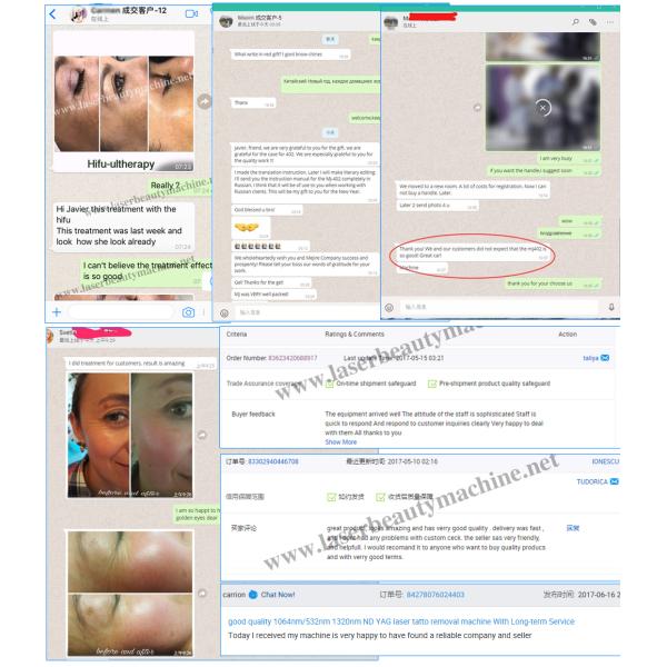 Fat Cavitation Vacuum Machine Weight Loss Physiotherapy Equipment