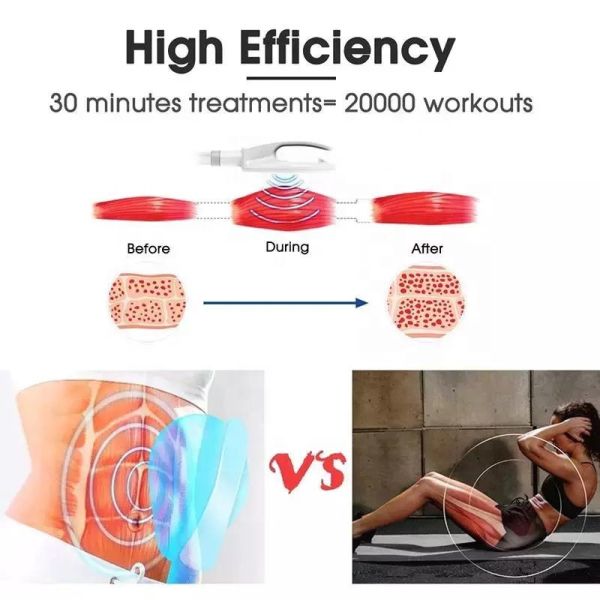 em sculpting machine for sale