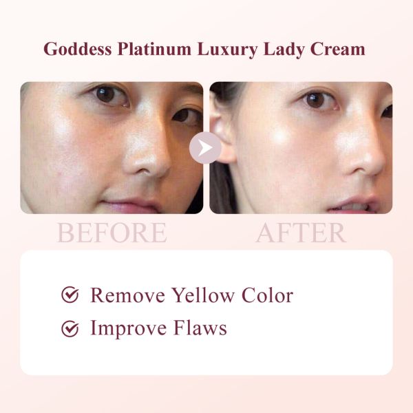 OEM Professional Lightning Face Cream for Men Shea Butter & Carnosine Based Oil Control Skin Whitening and Care