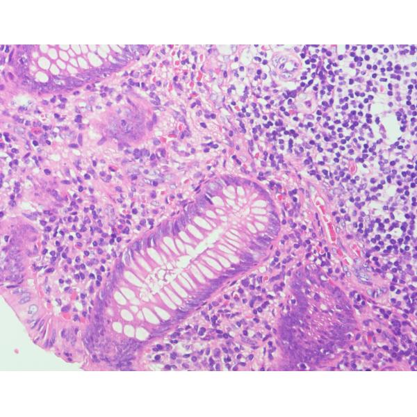 H-E Consistently High Clarity Stain Baso Clear Colourful Histology Stains