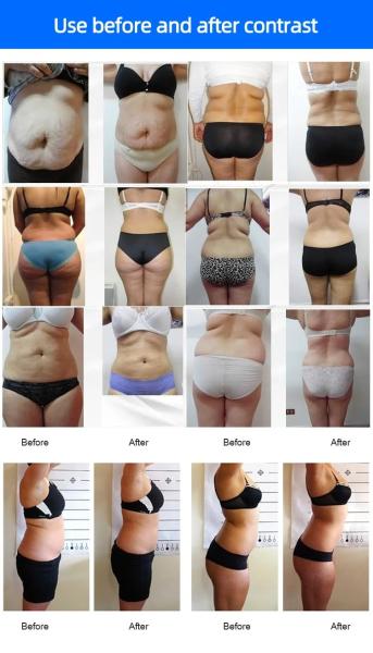 6D Lipo Laser Vaser luz vermelha Liposucção corpo emagrecimento polegada perda de forma aparelho de beleza máquina