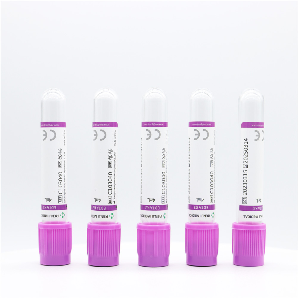 Best Price Vacuum Tube Supplier EDTA &NaF Glucose Tube Blood Collection Tube