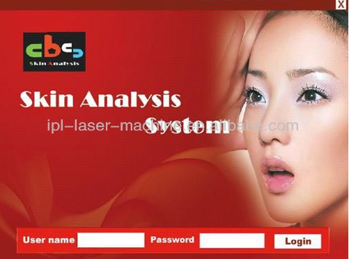 Hot!!! CE qualified best quality boxy skin and hair analyzer