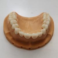 SHT Complete Zirconia System Blocks Staining Liquids and Protocols for Long-Lasting Dental Solutions