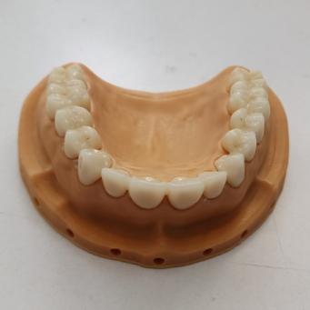 SHT Complete Zirconia System Blocks Staining Liquids and Protocols for Long-Lasting Dental Solutions