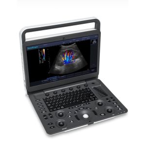 SonoScape Ultrasound Machine