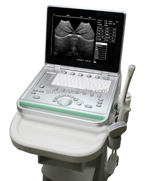 Portable ultrasound machine Laptop Ultrasound machine SU-7S with CE