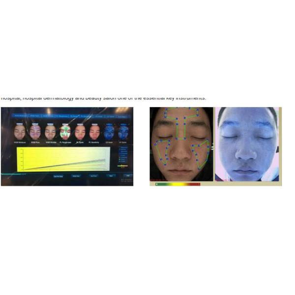 3D Digital Facial Skin Analysis Machine High Grade CE ISO Certificated
