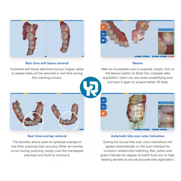 Цифровой интерфейс USB 3,0 блока развертки 3D CAD CAM зубоврачебные Intraoral электрические