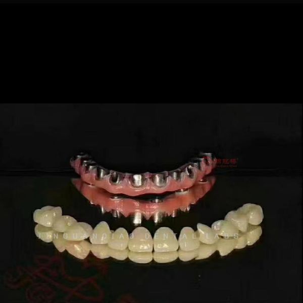 Titanium Abutment Dental Implant Screw Retained Crown 3D Laser Printing Customized