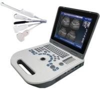 O equipamento obstétrico LCD do ultrassom do OEM OB indica o controle de TGC