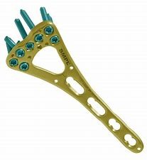 Shoulder Hook  Collarbone  Distal Accumed Clavicle Fracture Plate Fixation