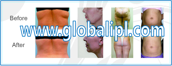 Ultrasonic Vertical Cavitation Slimming Machine For Skin Life / Body Shaping